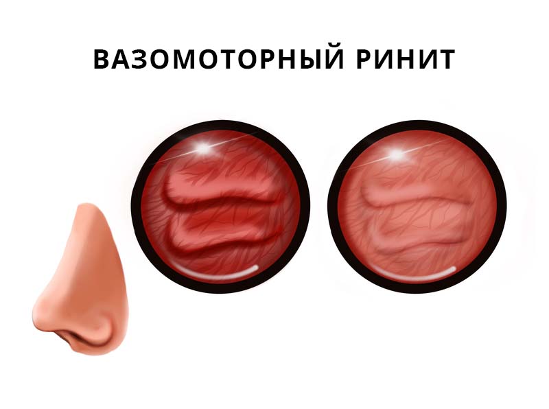 krov vo sne predvestnik bedy ili znak obnovleniya
